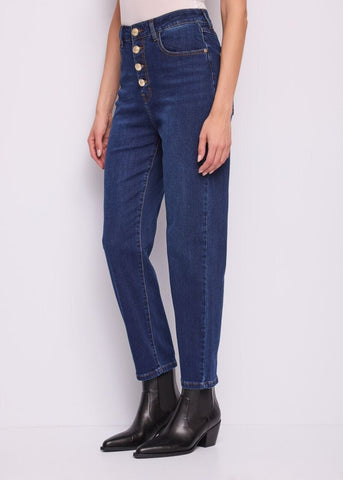 Jeans a vita alta da donna con bottoni - dettaglio 2
